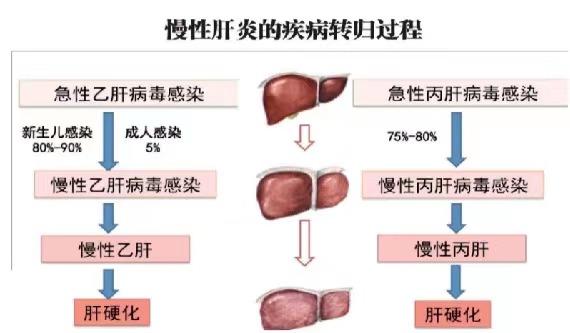 【健康科普】世界肝炎日——堅持早預(yù)防，加強檢測發(fā)現(xiàn)，規(guī)范抗病毒治療